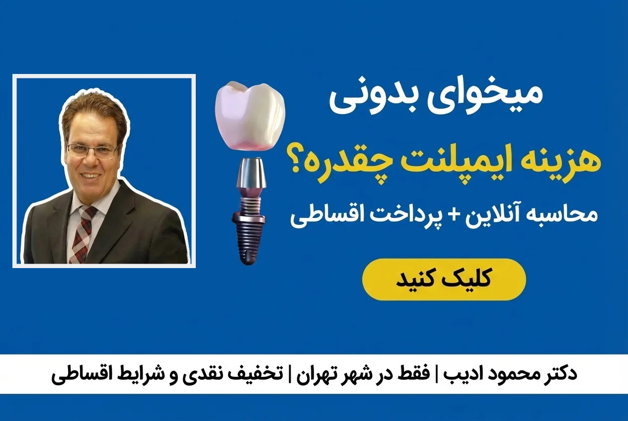 ایمپلنت دندان در مرکز تهران؛ وقتی قرار است دوباره با خیال راحت لبخند بزنید